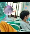 308激光在医院照一个地方算一次吗